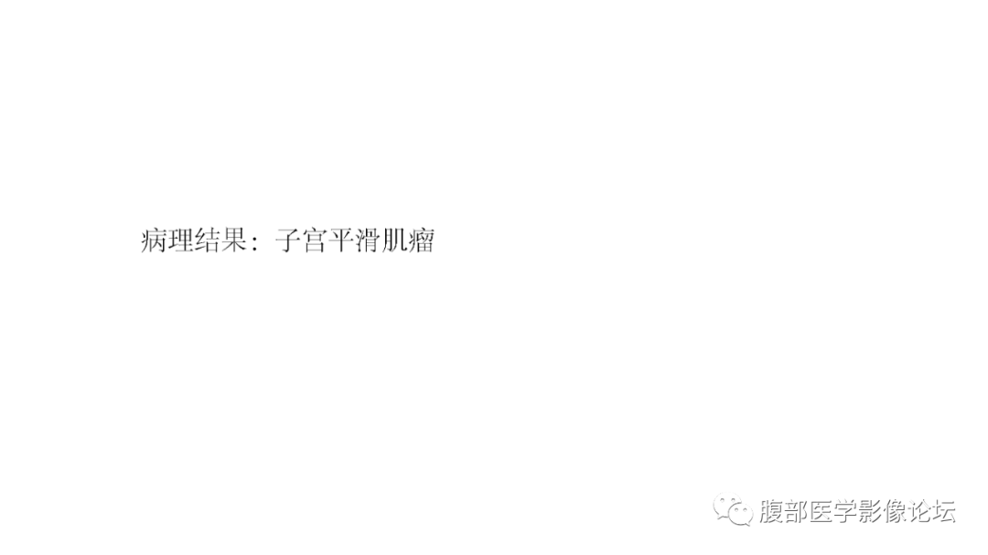 影像PPT - 【病例】子宫平滑肌瘤1例MR影像诊断-8