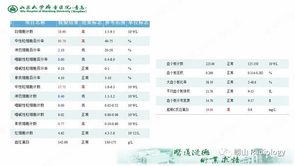 影像PPT - 【病例】鞍区软骨肉瘤1例CT及MR影像-5