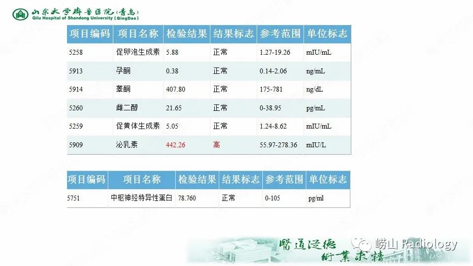 影像PPT - 【病例】鞍区软骨肉瘤1例CT及MR影像-6