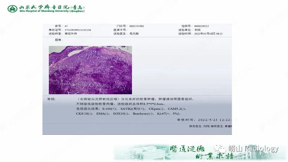 影像PPT - 【病例】鞍区软骨肉瘤1例CT及MR影像-9