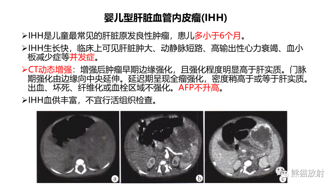 影像PPT - 【病例】肝母细胞瘤 VS FNH-45