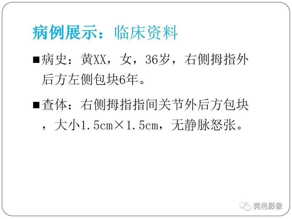 影像PPT - 【PPT】腱鞘巨细胞瘤影像诊断-2
