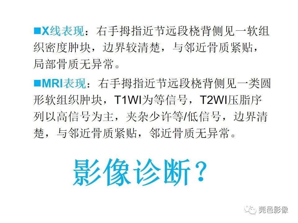 影像PPT - 【PPT】腱鞘巨细胞瘤影像诊断-5