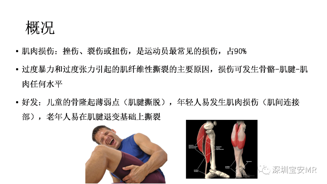 影像PPT - 【PPT】肌肉损伤和后遗症-2