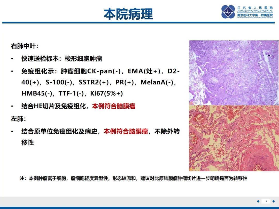 影像PPT - 【PPT】​罕见的肺内脑膜瘤结节—肺转移性脑膜瘤-10