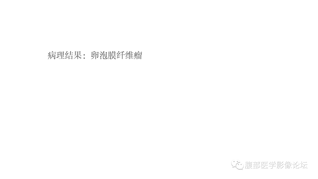 影像PPT - 【病例】卵巢卵泡膜纤维瘤1例MR影像-9 影像PPT - 【病例】卵巢卵泡膜纤维瘤1例MR影像-9