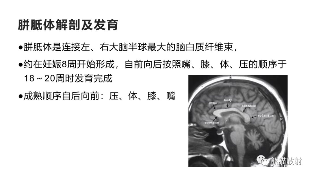 影像PPT - 【PPT】胼胝体 弥漫性大B细胞淋巴瘤 VS 胶质母细胞瘤-18