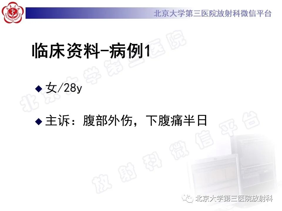 影像PPT - 【PPT】镰状韧带旁肝假性病灶-2