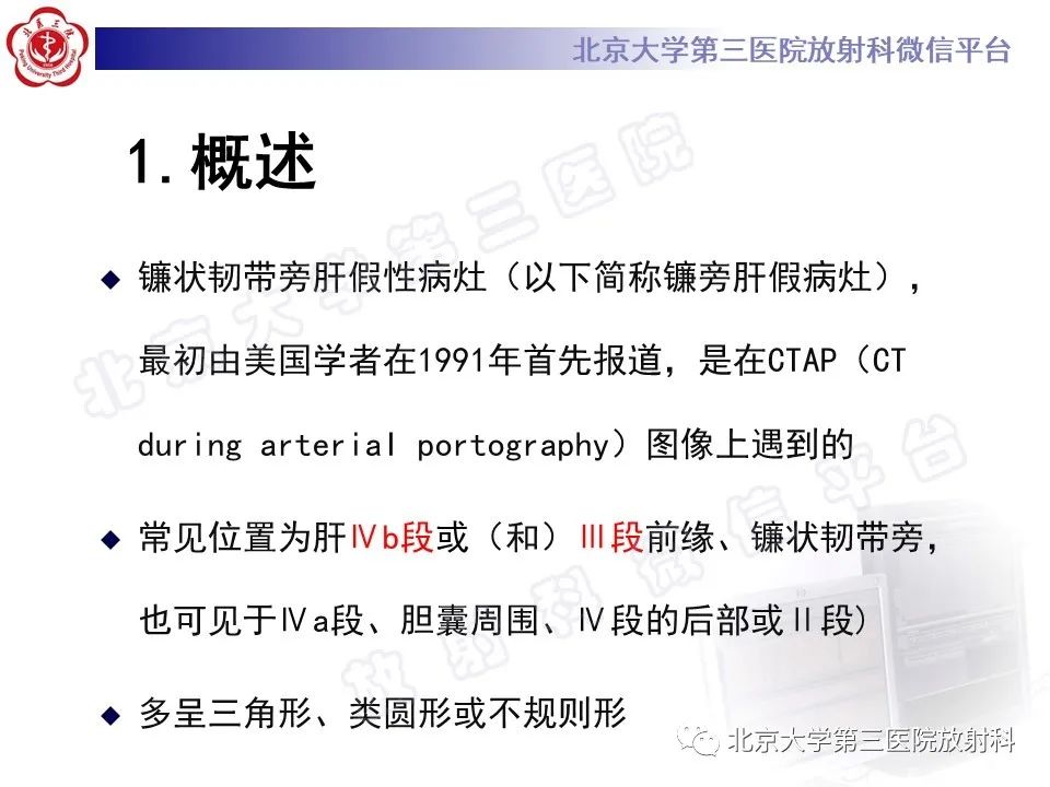 影像PPT - 【PPT】镰状韧带旁肝假性病灶-11