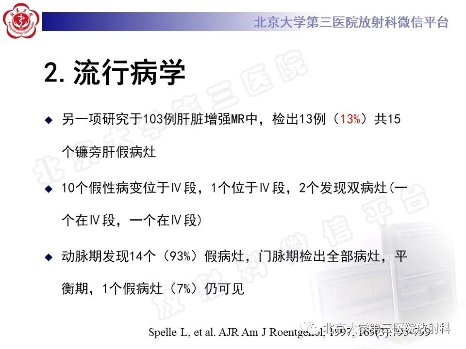 影像PPT - 【PPT】镰状韧带旁肝假性病灶-18