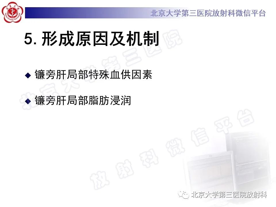 影像PPT - 【PPT】镰状韧带旁肝假性病灶-25