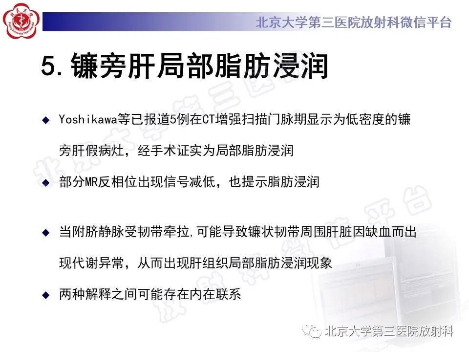 影像PPT - 【PPT】镰状韧带旁肝假性病灶-27