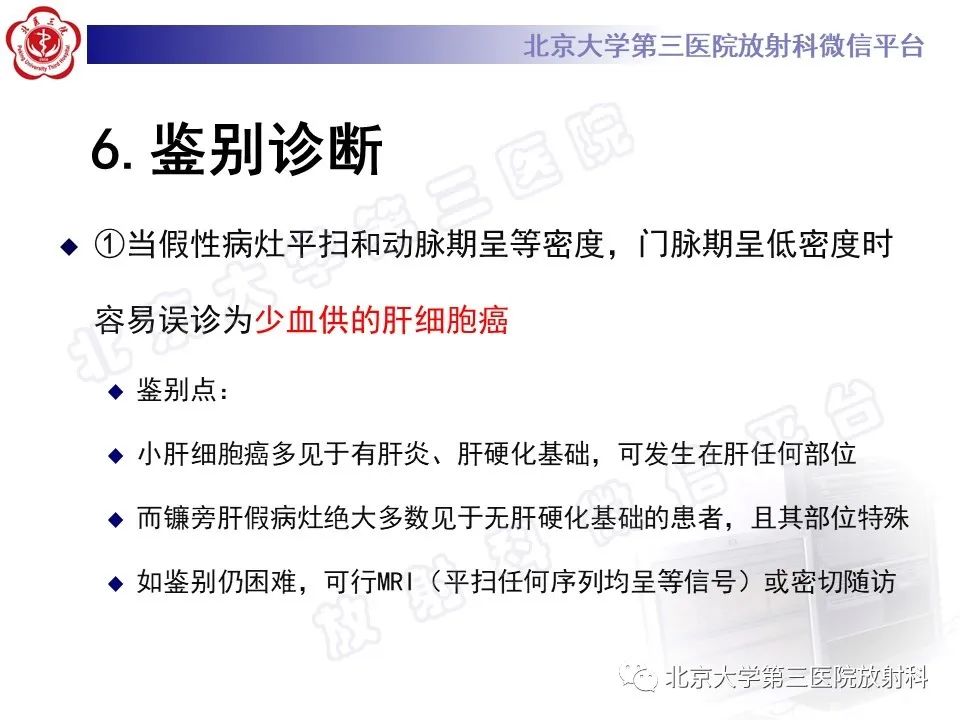 影像PPT - 【PPT】镰状韧带旁肝假性病灶-28