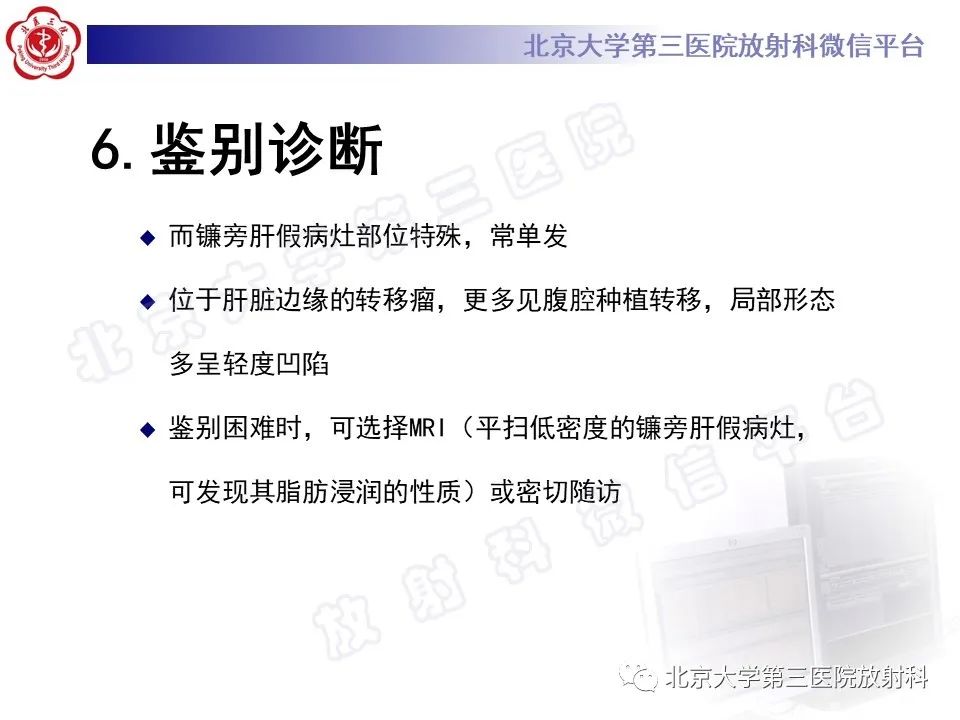 影像PPT - 【PPT】镰状韧带旁肝假性病灶-31