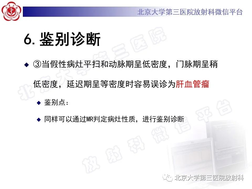 影像PPT - 【PPT】镰状韧带旁肝假性病灶-32