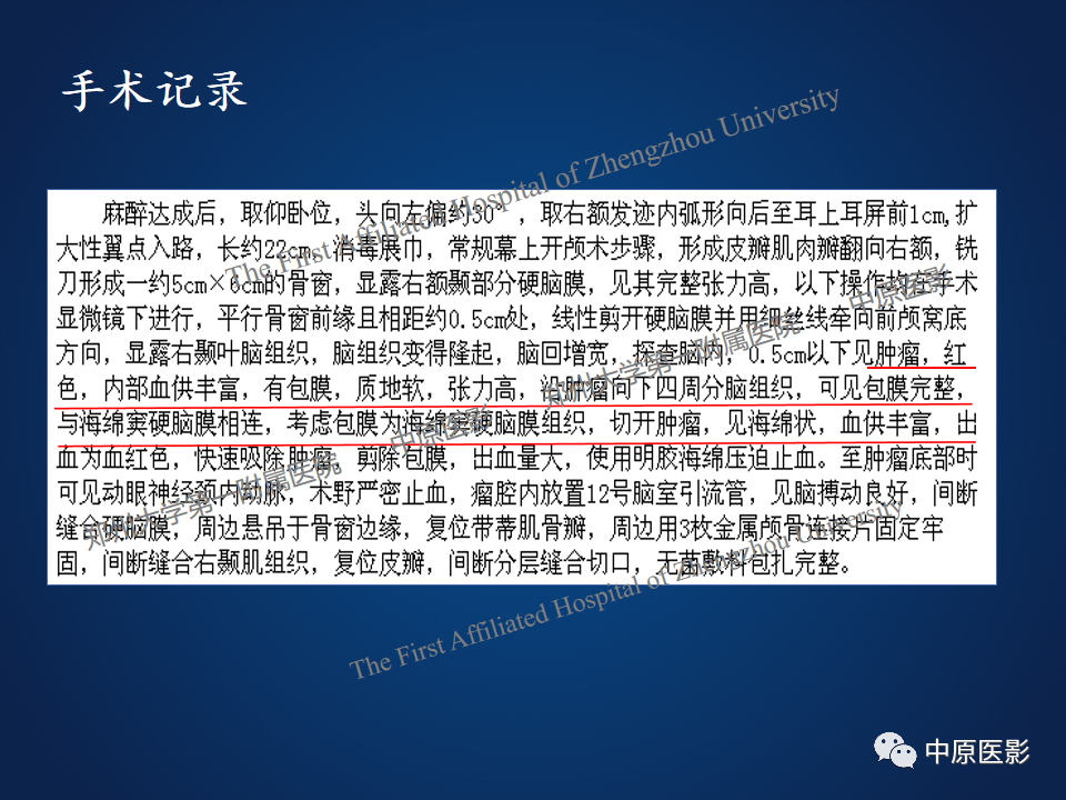 影像PPT - 【病例】鞍旁海绵状血管瘤1例MR-8