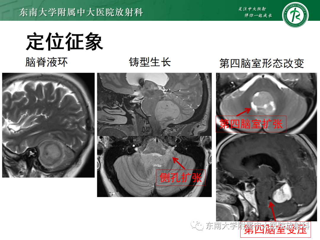 影像PPT - 【PPT】小脑常见占位诊断思路-11