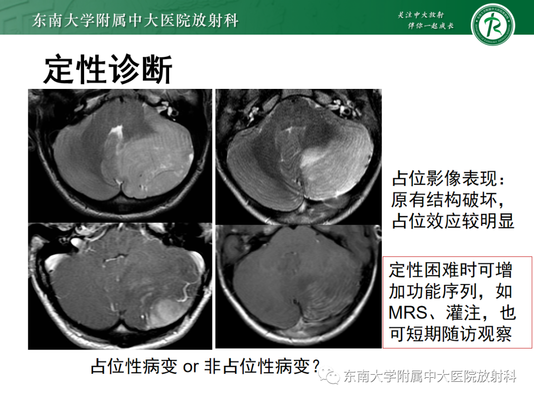 影像PPT - 【PPT】小脑常见占位诊断思路-12