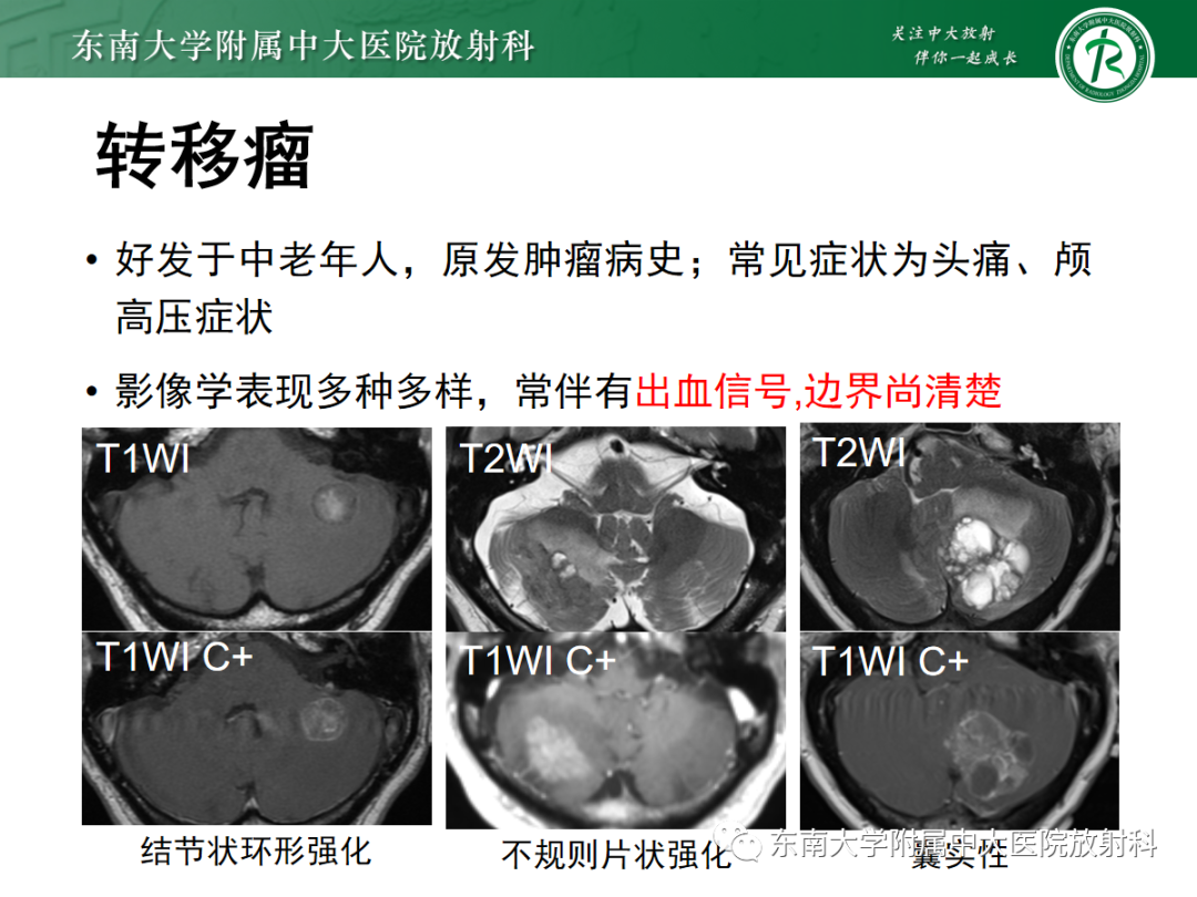 影像PPT - 【PPT】小脑常见占位诊断思路-14
