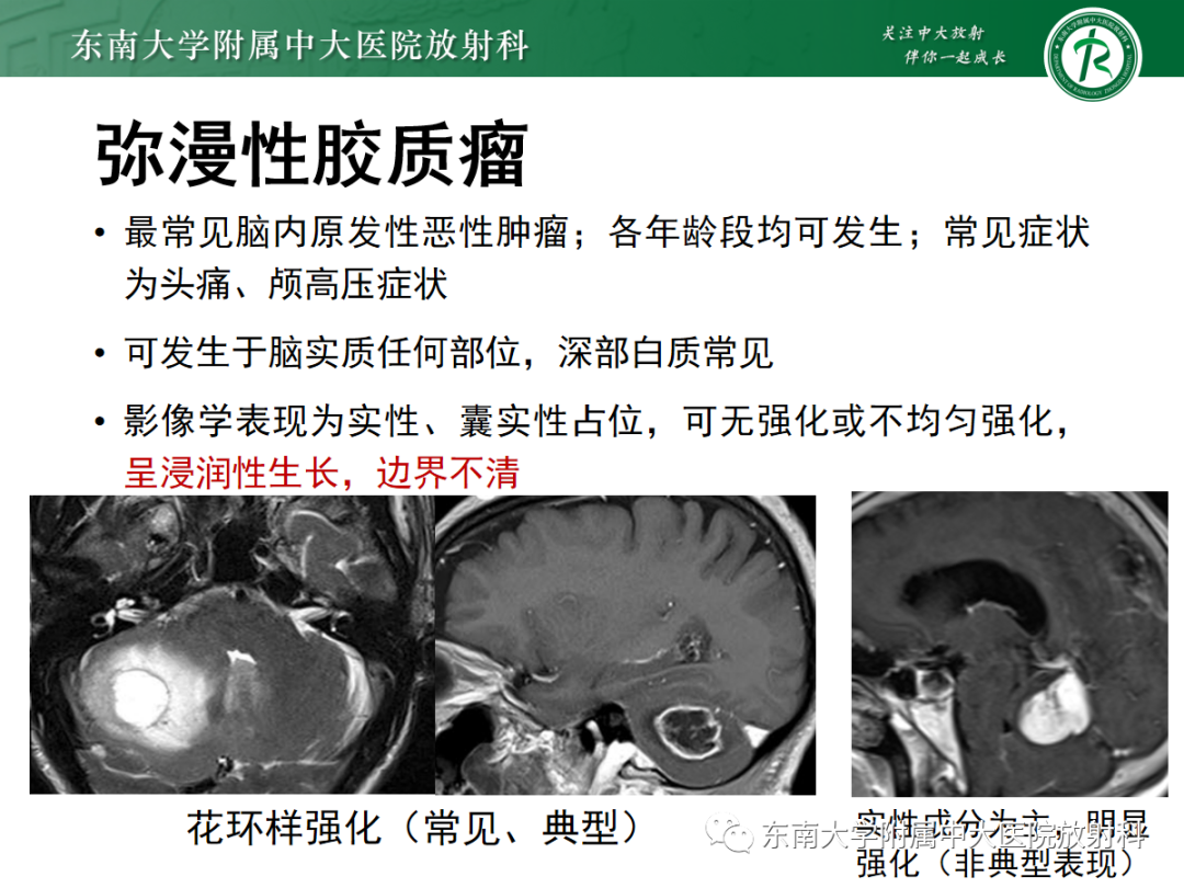 影像PPT - 【PPT】小脑常见占位诊断思路-18
