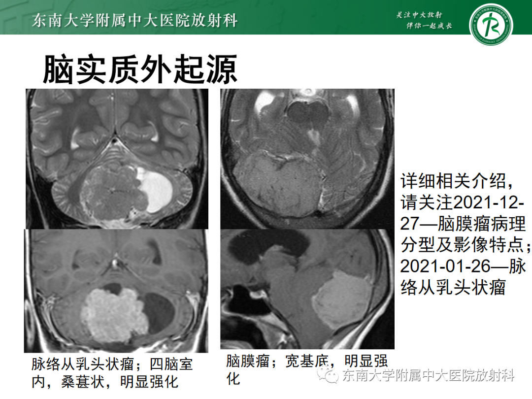 影像PPT - 【PPT】小脑常见占位诊断思路-22