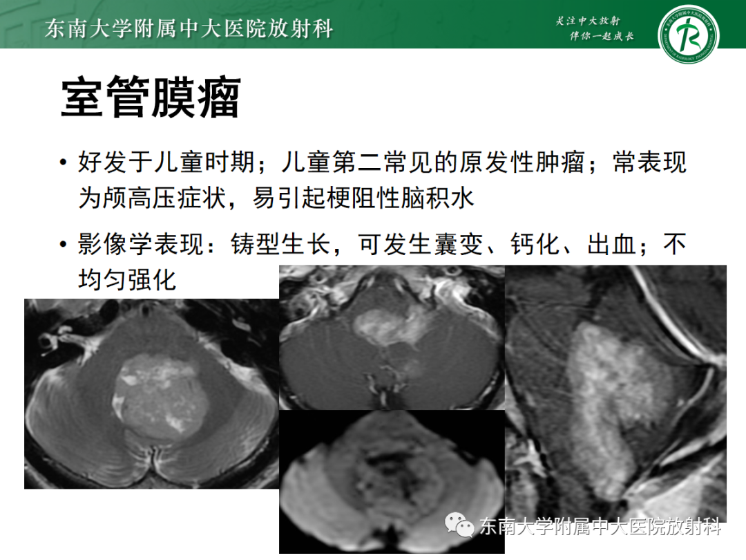 影像PPT - 【PPT】小脑常见占位诊断思路-25