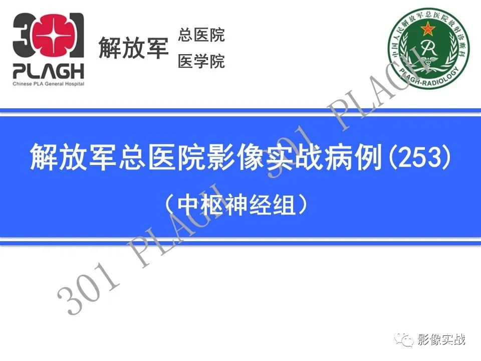 影像PPT - 【PPT】具有毛细胞样特征的高级别星形细胞瘤1例MR-1
