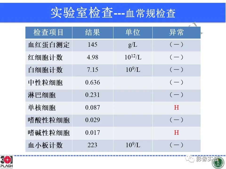影像PPT - 【PPT】具有毛细胞样特征的高级别星形细胞瘤1例MR-4