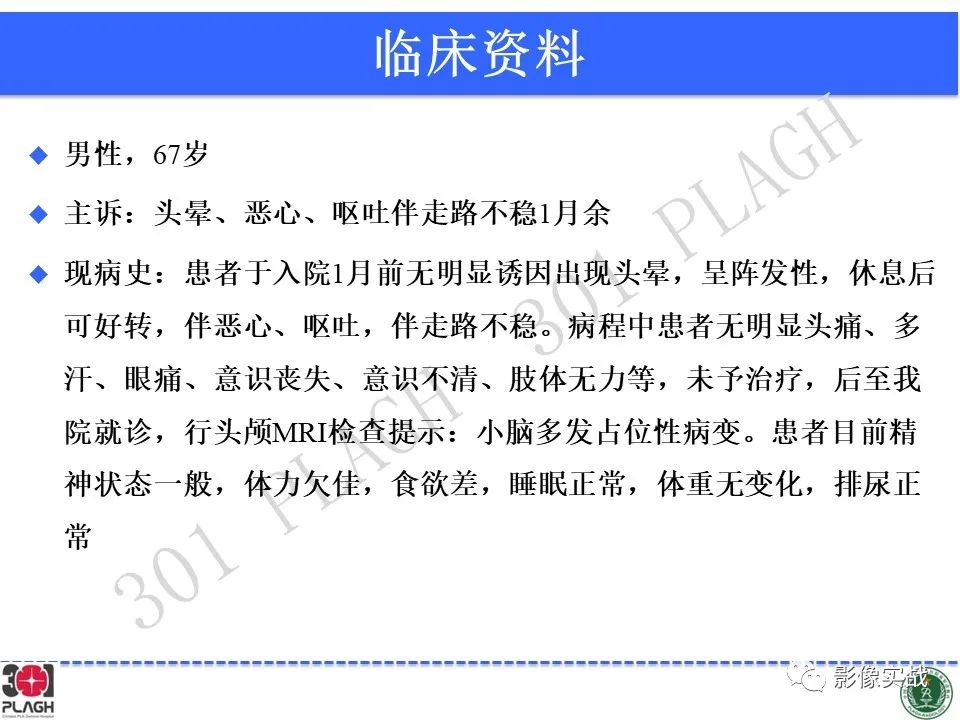 影像PPT - 【PPT】具有毛细胞样特征的高级别星形细胞瘤1例MR-2