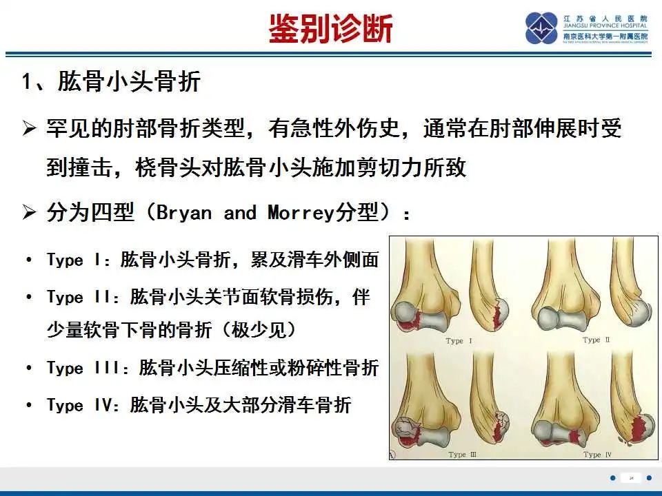 影像PPT - 【PPT】肘关节剥脱性骨软骨炎-32
