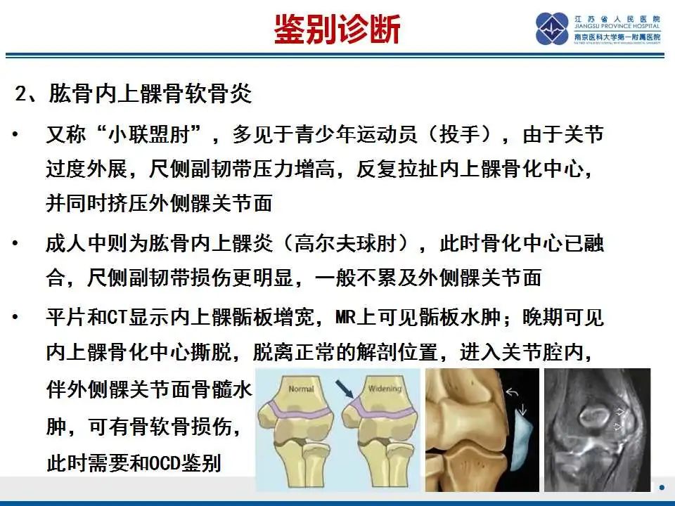 影像PPT - 【PPT】肘关节剥脱性骨软骨炎-34