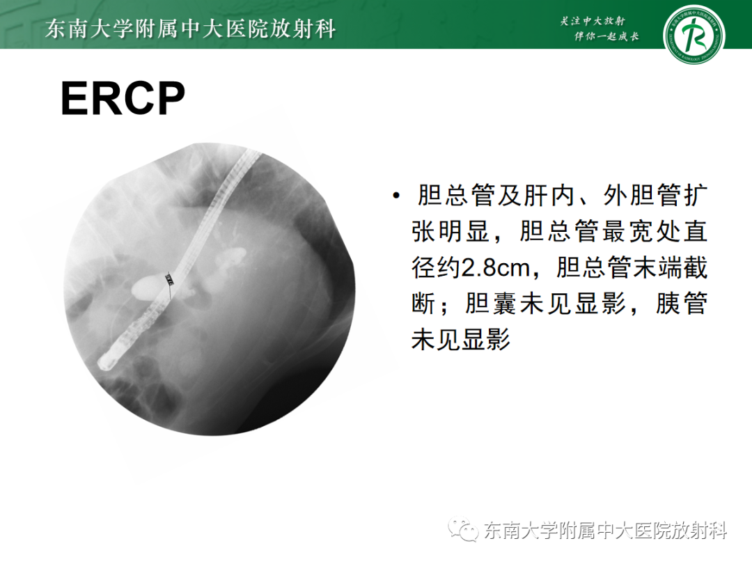 影像PPT - 【PPT】理影外合——胰腺癌-8