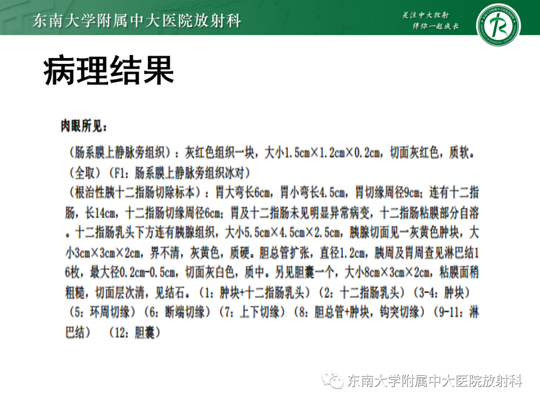 影像PPT - 【PPT】理影外合——胰腺癌-10