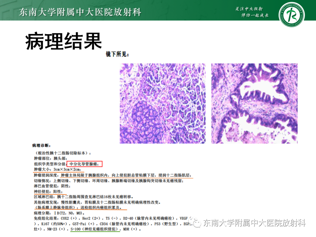 影像PPT - 【PPT】理影外合——胰腺癌-11