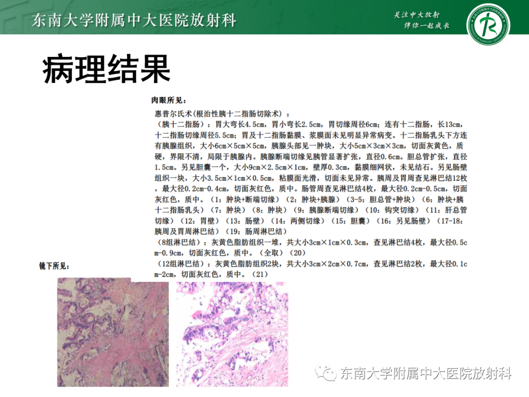影像PPT - 【PPT】理影外合——胰腺癌-14