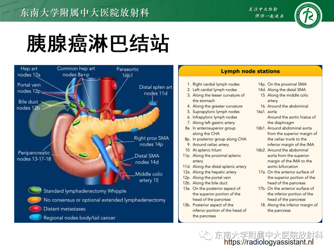 影像PPT - 【PPT】理影外合——胰腺癌-17