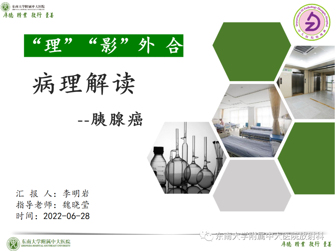影像PPT - 【PPT】理影外合——胰腺癌-19