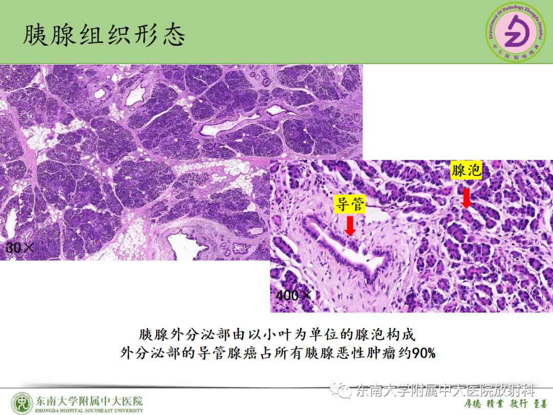 影像PPT - 【PPT】理影外合——胰腺癌-22