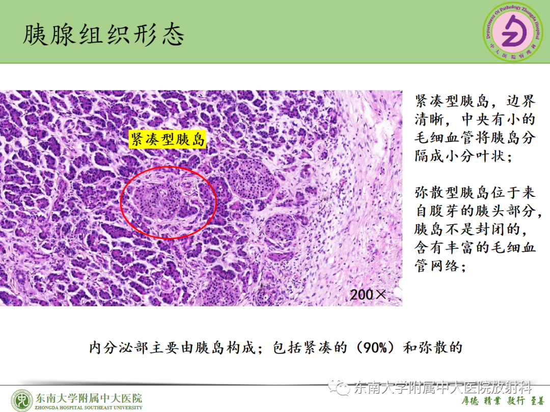 影像PPT - 【PPT】理影外合——胰腺癌-23