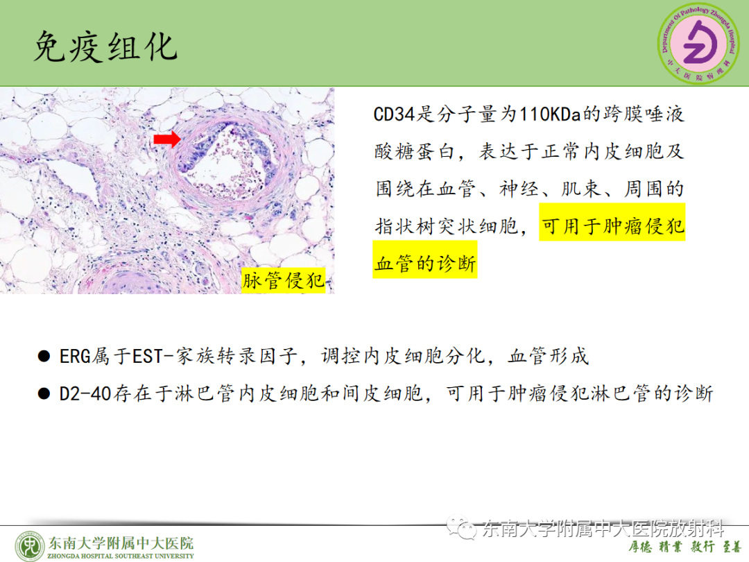 影像PPT - 【PPT】理影外合——胰腺癌-31