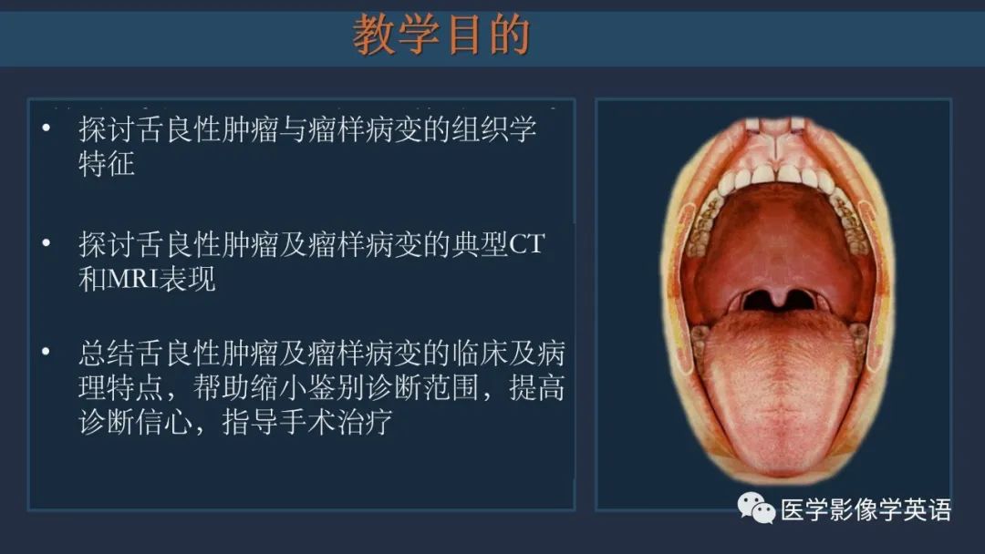 影像PPT - 【PPT】舌良性肿瘤及肿瘤样病变的MR表现及影像与病理对照分析-3 影像PPT - 【PPT】舌良性肿瘤及肿瘤样病变的MR表现及影像与病理对照分析-3