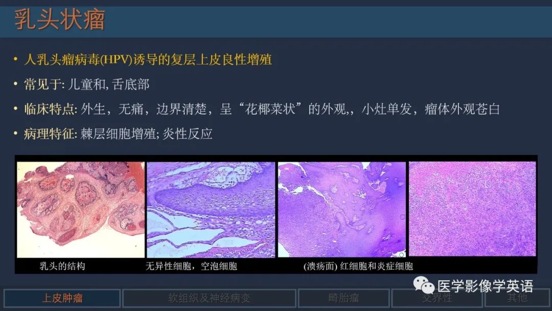 影像PPT - 【PPT】舌良性肿瘤及肿瘤样病变的MR表现及影像与病理对照分析-11 影像PPT - 【PPT】舌良性肿瘤及肿瘤样病变的MR表现及影像与病理对照分析-11