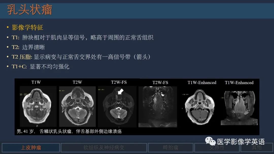 影像PPT - 【PPT】舌良性肿瘤及肿瘤样病变的MR表现及影像与病理对照分析-13 影像PPT - 【PPT】舌良性肿瘤及肿瘤样病变的MR表现及影像与病理对照分析-13