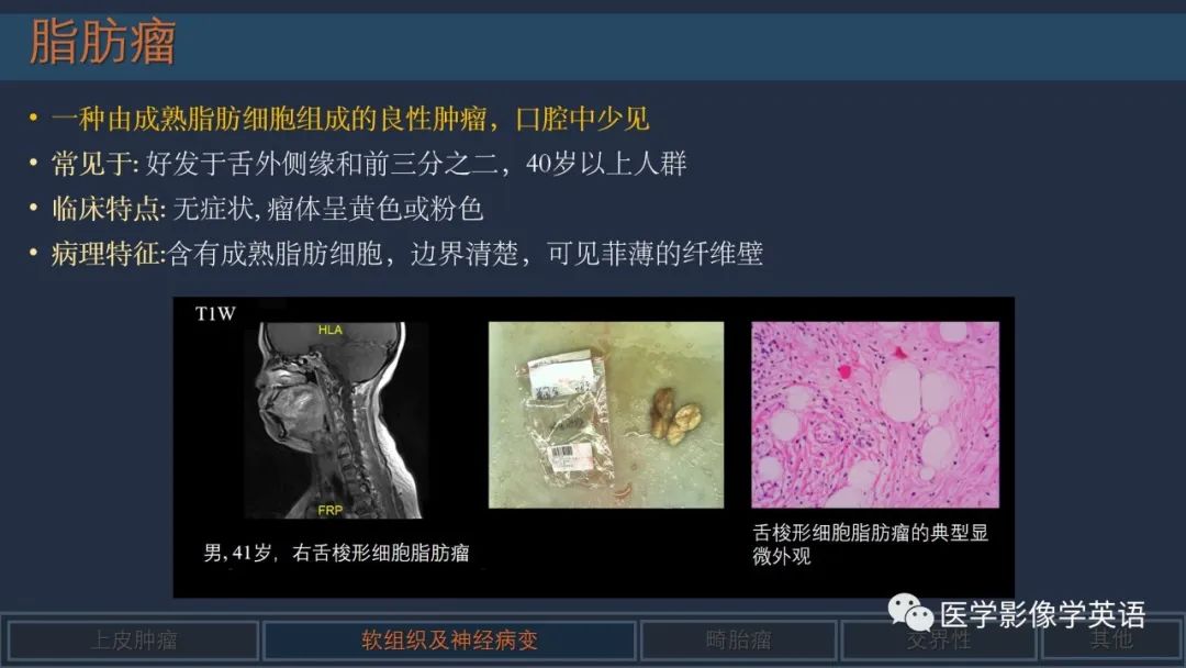 影像PPT - 【PPT】舌良性肿瘤及肿瘤样病变的MR表现及影像与病理对照分析-15 影像PPT - 【PPT】舌良性肿瘤及肿瘤样病变的MR表现及影像与病理对照分析-15