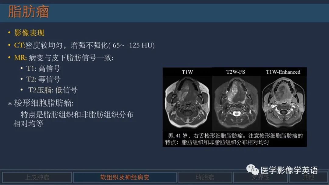 影像PPT - 【PPT】舌良性肿瘤及肿瘤样病变的MR表现及影像与病理对照分析-17 影像PPT - 【PPT】舌良性肿瘤及肿瘤样病变的MR表现及影像与病理对照分析-17