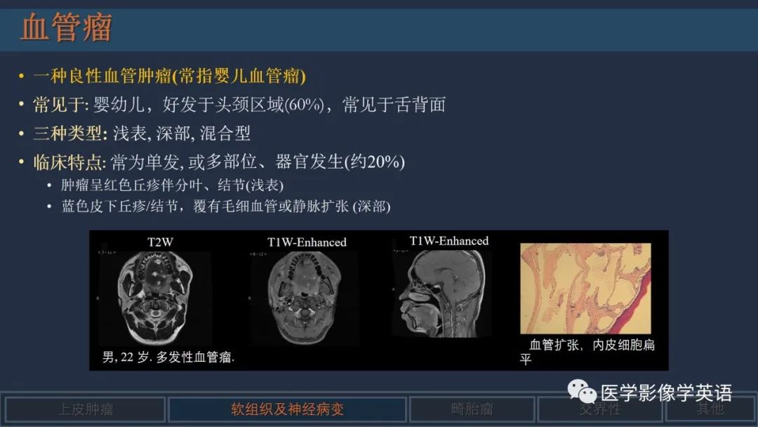 影像PPT - 【PPT】舌良性肿瘤及肿瘤样病变的MR表现及影像与病理对照分析-23 影像PPT - 【PPT】舌良性肿瘤及肿瘤样病变的MR表现及影像与病理对照分析-23