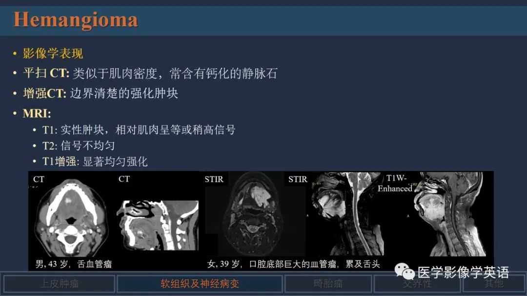 影像PPT - 【PPT】舌良性肿瘤及肿瘤样病变的MR表现及影像与病理对照分析-25 影像PPT - 【PPT】舌良性肿瘤及肿瘤样病变的MR表现及影像与病理对照分析-25