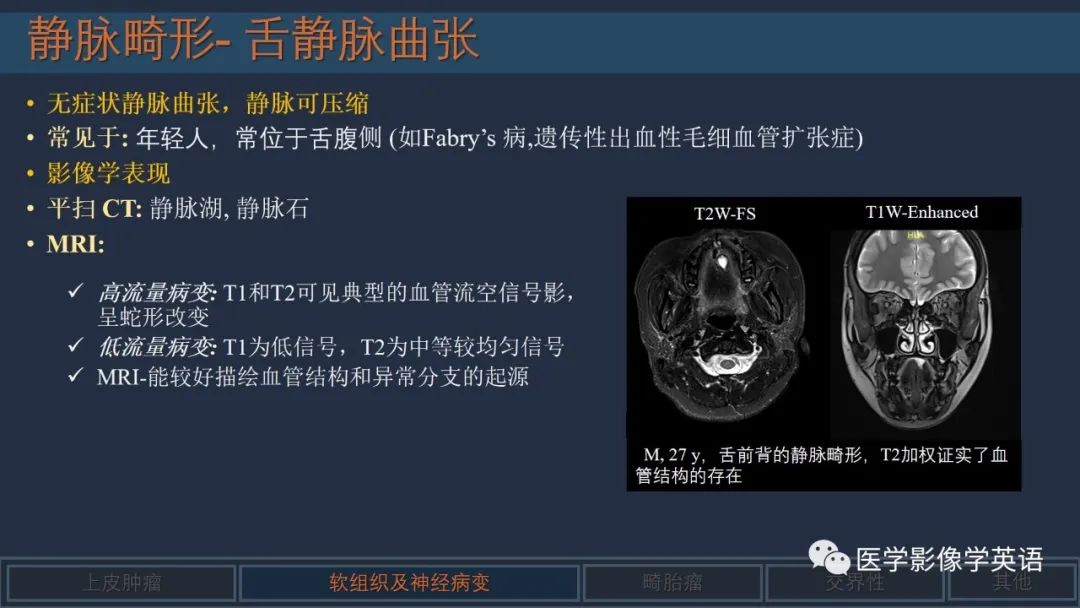 影像PPT - 【PPT】舌良性肿瘤及肿瘤样病变的MR表现及影像与病理对照分析-27 影像PPT - 【PPT】舌良性肿瘤及肿瘤样病变的MR表现及影像与病理对照分析-27