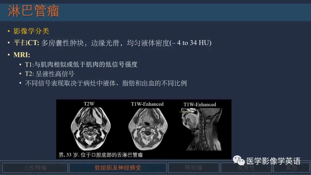 影像PPT - 【PPT】舌良性肿瘤及肿瘤样病变的MR表现及影像与病理对照分析-31 影像PPT - 【PPT】舌良性肿瘤及肿瘤样病变的MR表现及影像与病理对照分析-31