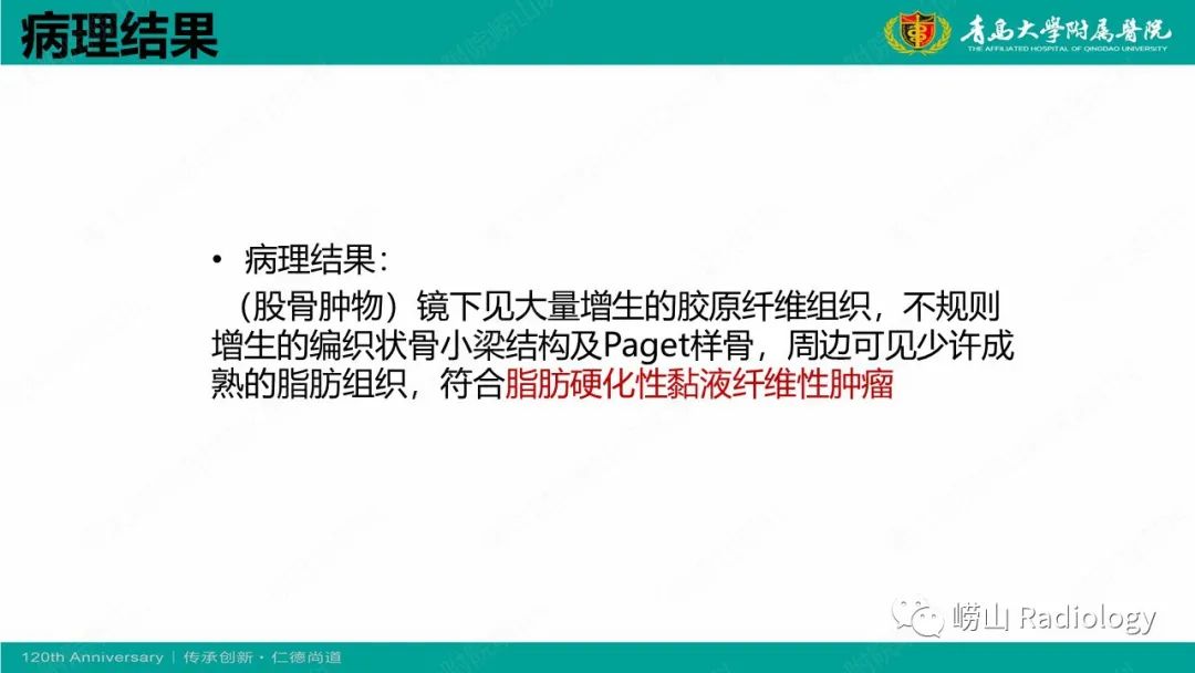 影像PPT - 【病例】脂肪硬化性黏液纤维性肿瘤1例X线CT及MR-11